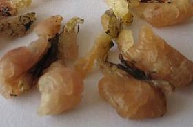 Hama Oil: Benefits and Uses in Traditional Chinese Medicine