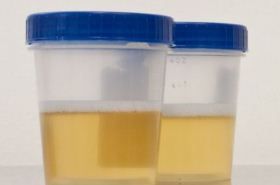 Human Urine: Uses and Benefits