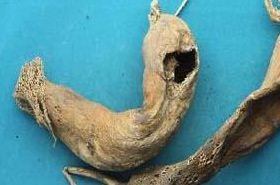 Di Kulou: Efficacy and Indications of Aged Radish Root in TCM