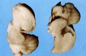 Chicken Brain_Traditional Chinese Medicine Benefits and Uses